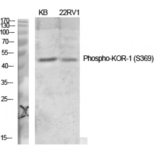 OPRK1 / Kappa Opioid Receptor Antibody - Western blot of Phospho-KOR-1 (S369) antibody