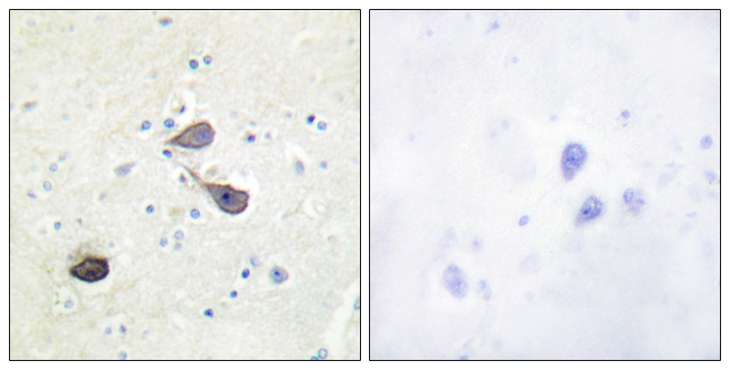 OPRK1 / Kappa Opioid Receptor Antibody - Immunohistochemistry analysis of paraffin-embedded human brain tissue, using KOR-1 Antibody. The picture on the right is blocked with the synthesized peptide.