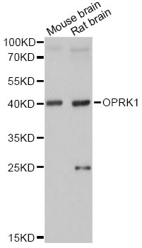 OPRK1 / Kappa Opioid Receptor Antibody - Western blot analysis of extracts of various cell lines, using OPRK1 antibody at 1:1000 dilution. The secondary antibody used was an HRP Goat Anti-Rabbit IgG (H+L) at 1:10000 dilution. Lysates were loaded 25ug per lane and 3% nonfat dry milk in TBST was used for blocking. An ECL Kit was used for detection and the exposure time was 5s.