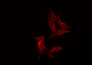 OPRK1 / Kappa Opioid Receptor Antibody - Staining HeLa cells by IF/ICC. The samples were fixed with PFA and permeabilized in 0.1% Triton X-100, then blocked in 10% serum for 45 min at 25°C. The primary antibody was diluted at 1:200 and incubated with the sample for 1 hour at 37°C. An Alexa Fluor 594 conjugated goat anti-rabbit IgG (H+L) Ab, diluted at 1/600, was used as the secondary antibody.