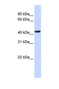 OPRK1 / Kappa Opioid Receptor Antibody - OPRK1 / Kappa Opioid Receptor antibody Western blot of Fetal Brain lysate. Antibody concentration 1 ug/ml. This image was taken for the unconjugated form of this product. Other forms have not been tested.