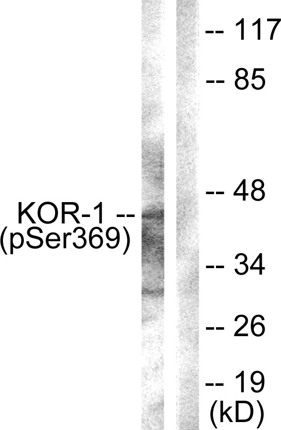 OPRK1 / Kappa Opioid Receptor Antibody - Western blot analysis of lysates from NIH/3T3 cells, using KOR-1 (Phospho-Ser369) Antibody. The lane on the right is blocked with the phospho peptide.
