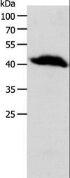 OPRL1 / ORL1 Antibody - Western blot analysis of Human liver cancer tissue, using OPRL1 Polyclonal Antibody at dilution of 1:900.