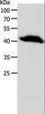 OPRL1 / ORL1 Antibody - Western blot analysis of Human liver cancer tissue, using OPRL1 Polyclonal Antibody at dilution of 1:900.