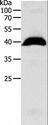 OPRL1 / ORL1 Antibody - Western blot analysis of Human liver cancer tissue, using OPRL1 Polyclonal Antibody at dilution of 1:1100.