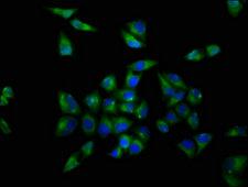 OPRL1 / ORL1 Antibody - Immunofluorescence staining of Hela cells with OPRL1 Antibody at 1:200, counter-stained with DAPI. The cells were fixed in 4% formaldehyde, permeabilized using 0.2% Triton X-100 and blocked in 10% normal Goat Serum. The cells were then incubated with the antibody overnight at 4°C. The secondary antibody was Alexa Fluor 488-congugated AffiniPure Goat Anti-Rabbit IgG(H+L).