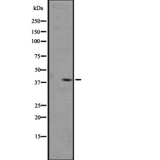 OPRL1 / ORL1 Antibody - Western blot analysis of OPRL1 expression in A431 whole cells lysate. The lane on the left is treated with the antigen-specific peptide.