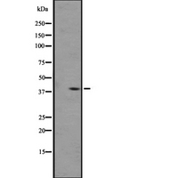 OPRL1 / ORL1 Antibody - Western blot analysis of OPRL1 expression in A431 whole cells lysate. The lane on the left is treated with the antigen-specific peptide.