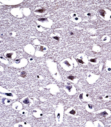 OPRM1 / Mu Opioid Receptor Antibody - OPRM1 Antibody immunohistochemistry of formalin-fixed and paraffin-embedded human brain tissue followed by peroxidase-conjugated secondary antibody and DAB staining.
