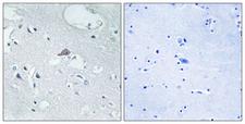 OPRM1 / Mu Opioid Receptor Antibody - Immunohistochemistry analysis of paraffin-embedded human brain tissue, using OPRM1 Antibody. The picture on the right is blocked with the synthesized peptide.