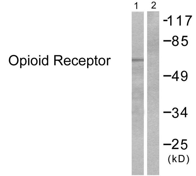 OPRM1 / Mu Opioid Receptor Antibody - Western blot analysis of lysates from 293 cells, treated with EGF 200ng/ml 30', using Opioid Receptor Antibody. The lane on the right is blocked with the synthesized peptide.