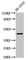 OPRM1 / Mu Opioid Receptor Antibody - Positive Western Blot detected in SH-SY5Y whole cell lysate. All lanes: OPRM1 antibody at 2.9 µg/ml Secondary Goat polyclonal to rabbit IgG at 1/50000 dilution. Predicted band size: 45, 44, 50, 48, 46, 56, 35, 37, 34, 14, 11, 21 KDa. Observed band size: 45 KDa