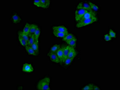 OPRM1 / Mu Opioid Receptor Antibody - Immunofluorescence staining of HepG2 cells with OPRM1 Antibody at 1:166, counter-stained with DAPI. The cells were fixed in 4% formaldehyde, permeabilized using 0.2% Triton X-100 and blocked in 10% normal Goat Serum. The cells were then incubated with the antibody overnight at 4°C. The secondary antibody was Alexa Fluor 488-congugated AffiniPure Goat Anti-Rabbit IgG(H+L).
