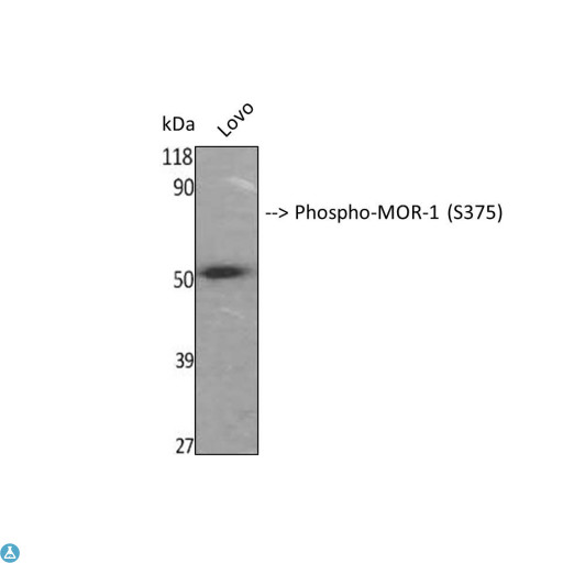 OPRM1 / Mu Opioid Receptor Antibody - Western Blot (WB) analysis of specific cells using Phospho-MOR-1 (S375) polyclonal antibody.