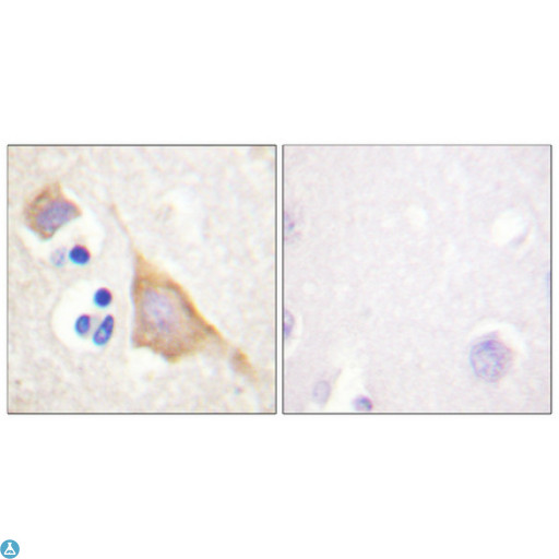 OPRM1 / Mu Opioid Receptor Antibody - Immunohistochemical analysis of paraffin-embedded Human brain. Antibody was diluted at 1:100 (4°C, overnight). High-pressure and temperature Tris-EDTA, pH8.0 was used for antibody retrieval. Negative control (right) obtained from antibody was pre-absorbed by immunogen peptide.