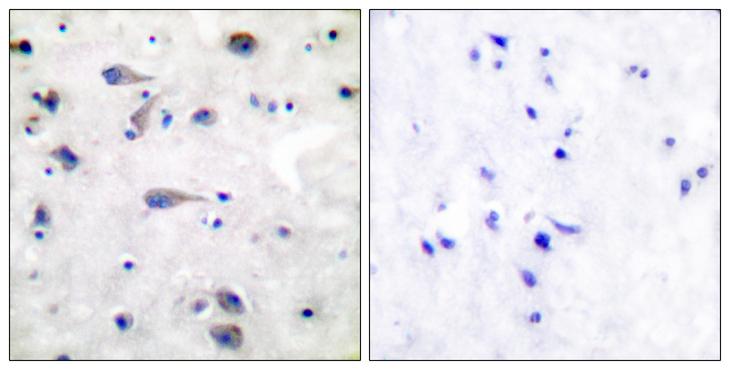 OPRM1 / Mu Opioid Receptor Antibody - Peptide - + Immunohistochemical analysis of paraffin-embedded human brain tissue using Opioid Receptor (Ab-375) antibody.