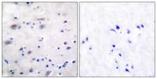 OPRM1 / Mu Opioid Receptor Antibody - Immunohistochemistry analysis of paraffin-embedded human brain, using Opioid Receptor (Phospho-Ser375) Antibody. The picture on the right is blocked with the phospho peptide.
