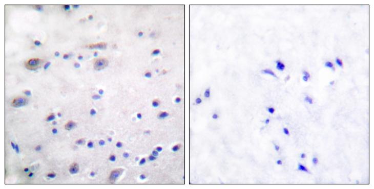 OPRM1 / Mu Opioid Receptor Antibody - P-peptide - + Immunohistochemical analysis of paraffin-embedded human brain tissue, using Opioid Receptor (phospho-Ser375) antibody.