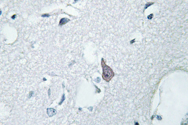 OPRM1 / Mu Opioid Receptor Antibody - IHC of MOR-1 (S57) pAb in paraffin-embedded human brain tissue.