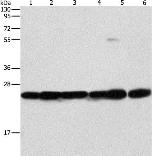 OPRS1 / SIGMAR1 Antibody - Western blot analysis of Mouse liver and brain tissue, 293T, A549, A431 and PC3 cell, using SIGMAR1 Polyclonal Antibody at dilution of 1:310.