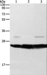 OPRS1 / SIGMAR1 Antibody - Western blot analysis of Mouse liver and brain tissue, A549 cell, using SIGMAR1 Polyclonal Antibody at dilution of 1:310.