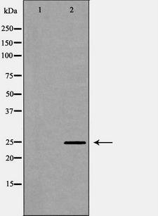 OPRS1 / SIGMAR1 Antibody - Western blot analysis of 293T whole cells lysates using SIGMAR1 antibody. The lane on the left is treated with the antigen-specific peptide.