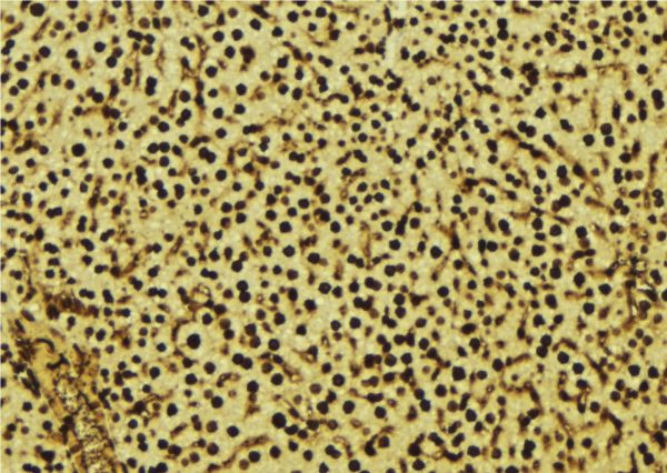 OPRS1 / SIGMAR1 Antibody - 1:100 staining mouse liver tissue by IHC-P. The sample was formaldehyde fixed and a heat mediated antigen retrieval step in citrate buffer was performed. The sample was then blocked and incubated with the antibody for 1.5 hours at 22°C. An HRP conjugated goat anti-rabbit antibody was used as the secondary.