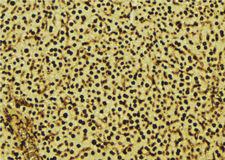 OPRS1 / SIGMAR1 Antibody - 1:100 staining mouse liver tissue by IHC-P. The sample was formaldehyde fixed and a heat mediated antigen retrieval step in citrate buffer was performed. The sample was then blocked and incubated with the antibody for 1.5 hours at 22°C. An HRP conjugated goat anti-rabbit antibody was used as the secondary.