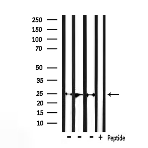 OPRS1 / SIGMAR1 Antibody - Western blot analysis of extracts of mouse liver, mouse muscle, rat brain tissue using SIGMAR1 antibody.