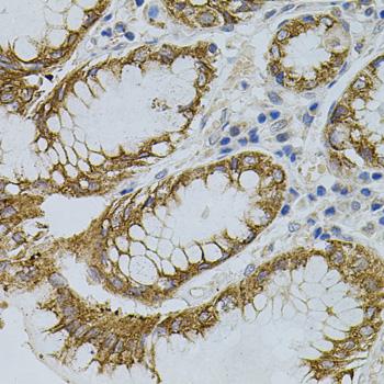 OPRS1 / SIGMAR1 Antibody - Immunohistochemistry of paraffin-embedded Human stomach using SIGMAR1 Polyclonal Antibody.