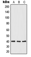 OPTC / Opticin Antibody - Western blot analysis of Opticin expression in HeLa (A); mouse heart (B); rat heart (C) whole cell lysates.
