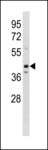 OPTIMEDIN / OLFM3 Antibody - OLFM3 Antibody western blot of 293 cell line lysates (35 ug/lane). The OLFM3 antibody detected the OLFM3 protein (arrow).