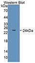 OPTIMEDIN / OLFM3 Antibody - Western blot of OPTIMEDIN / OLFM3 antibody.