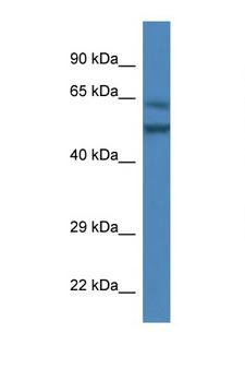 OPTIMEDIN / OLFM3 Antibody - OLFM3 antibody Western blot of Mouse liver lysate. Antibody concentration 1 ug/ml. This image was taken for the unconjugated form of this product. Other forms have not been tested.