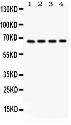 OPTN / Optineurin Antibody - Optineurin antibody Western blot. All lanes: Anti Optineurin at 0.5 ug/ml. Lane 1: HELA Whole Cell Lysate at 40 ug. Lane 2: U87 Whole Cell Lysate at 40 ug. Lane 3: SMMC Whole Cell Lysate at 40 ug. Lane 4: HT1080 Whole Cell Lysate at 40 ug. Predicted band size: 66 kD. Observed band size: 66 kD.