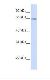 OPTN / Optineurin Antibody - MCF7 cell lysate. Antibody concentration: 1.0 ug/ml. Gel concentration: 12%.  This image was taken for the unconjugated form of this product. Other forms have not been tested.