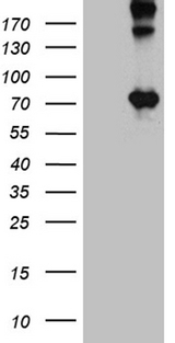 OPTN / Optineurin Antibody - HEK293T cells were transfected with the pCMV6-ENTRY control. (Left lane) or pCMV6-ENTRY OPTN. (Right lane) cDNA for 48 hrs and lysed