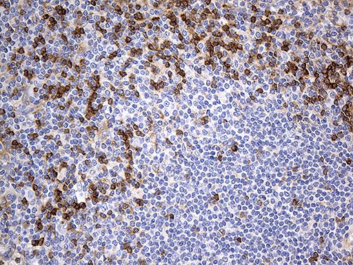 OPTN / Optineurin Antibody - Immunohistochemical staining of paraffin-embedded Human spleen tissue within the normal limits using anti-OPTN mouse monoclonal antibody. (Heat-induced epitope retrieval by 1mM EDTA in 10mM Tris buffer. (pH8.5) at 120°C for 3 min. (1:500)