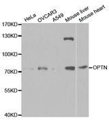 OPTN / Optineurin Antibody - Western blot analysis of extracts of various cell lines.