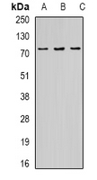 OPTN / Optineurin Antibody - Western blot analysis of Optineurin expression in HeLa (A); A549 (B); mouse liver (C) whole cell lysates.