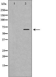 OPTN / Optineurin Antibody - Western blot analysis of mouse brain lysate using OPTN antibody. The lane on the left is treated with the antigen-specific peptide.