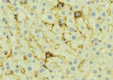 OPTN / Optineurin Antibody - 1:100 staining mouse liver tissue by IHC-P. The sample was formaldehyde fixed and a heat mediated antigen retrieval step in citrate buffer was performed. The sample was then blocked and incubated with the antibody for 1.5 hours at 22°C. An HRP conjugated goat anti-rabbit antibody was used as the secondary.