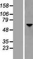 OPTN / Optineurin Protein - Western validation with an anti-DDK antibody * L: Control HEK293 lysate R: Over-expression lysate