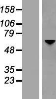 OPTN / Optineurin Protein - Western validation with an anti-DDK antibody * L: Control HEK293 lysate R: Over-expression lysate