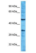 OR10A2 Antibody - OR10A2 antibody Western Blot of HCT15. Antibody dilution: 1 ug/ml.  This image was taken for the unconjugated form of this product. Other forms have not been tested.