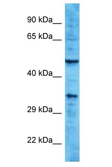 OR10A2 Antibody - OR10A2 antibody Western Blot of HCT15. Antibody dilution: 1 ug/ml.  This image was taken for the unconjugated form of this product. Other forms have not been tested.