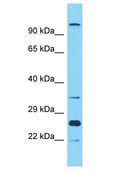 OR10A2 Antibody - OR10A2 antibody Western Blot of THP-1. Antibody dilution: 1 ug/ml.  This image was taken for the unconjugated form of this product. Other forms have not been tested.