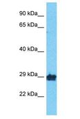 OR10A2 Antibody - OR10A2 antibody Western Blot of RPMI-8226. Antibody dilution: 1 ug/ml.  This image was taken for the unconjugated form of this product. Other forms have not been tested.