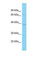OR10A3 Antibody - Western blot of Human HeLa. OR10A3 antibody dilution 1.0 ug/ml.  This image was taken for the unconjugated form of this product. Other forms have not been tested.