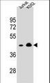 OR10A4 Antibody - OR10A4 Antibody western blot of Jurkat,K562 cell line lysates (35 ug/lane). The OR10A4 antibody detected the OR10A4 protein (arrow).